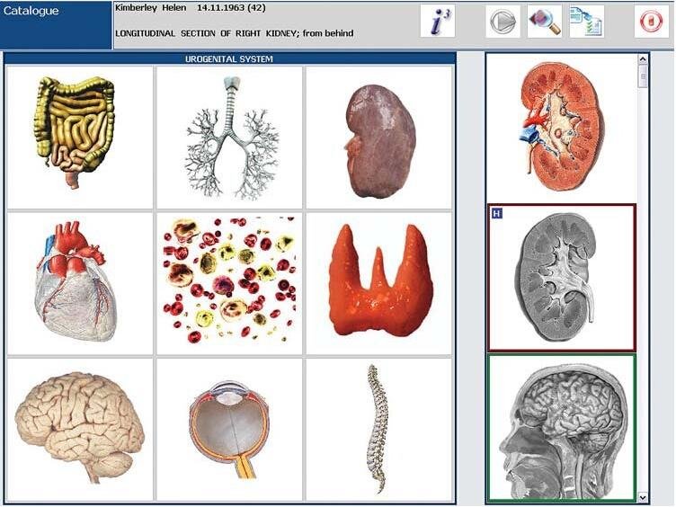 Metatron Hunter 4025 NLS Analysis