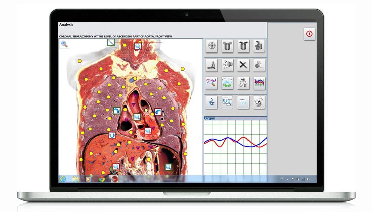 Metatron Hunter 4025 NLS Scan
