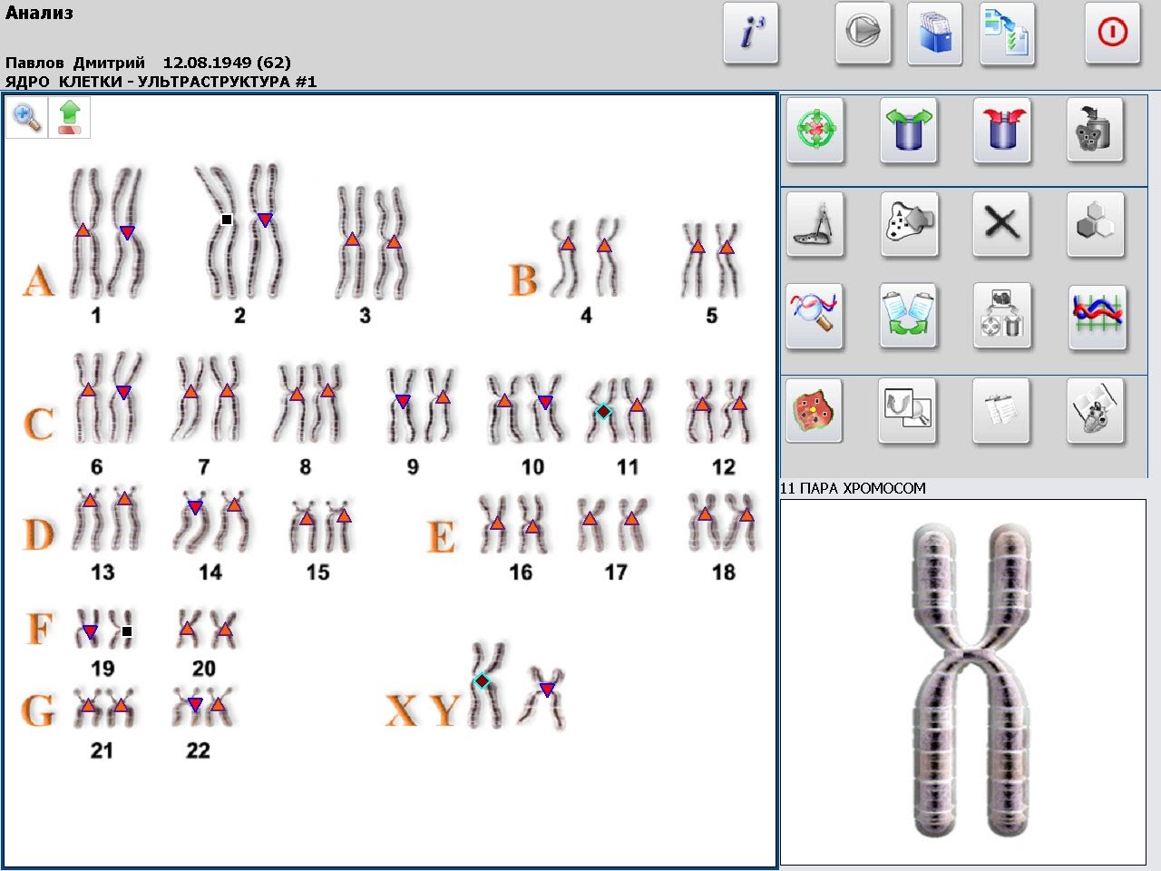 Metatron Hunter 4025 NLS Analysis
