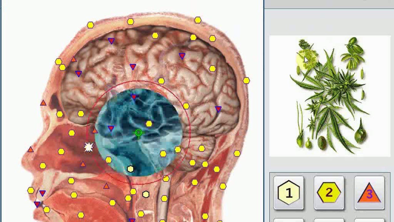 Metatron Hunter 4025 NLS Scan