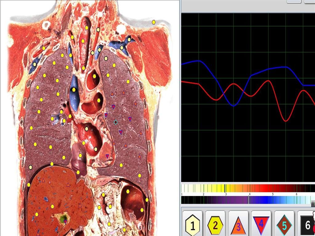 Metatron Hunter 4025 NLS Scan