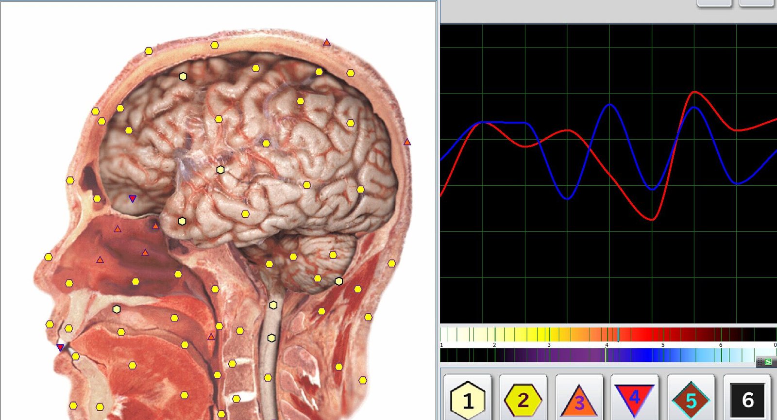 Metatron Hunter 4025 NLS Scan